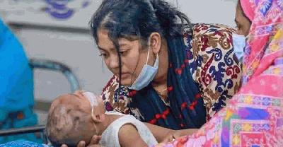 হাম ও উপসর্গে প্রাণ গেল আরও ৯ শিশুর