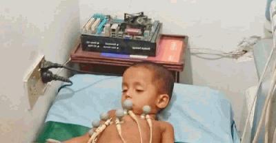 রায়গঞ্জে সাপের কামড়ে প্রাণ গেল তিন বছরের শিশুর 