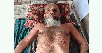 সুস্থ হতে চান লতিফ, চিকিৎসার পথে বড় বাধা অর্থ