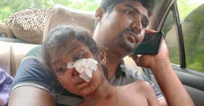ক্লাস চলাকালে ফ্যান খুলে পড়ে আহত প্রথম শ্রেণির ছাত্রী
